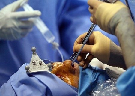 هشدار پزشکی قانونی برای انجام عمل‌های زیبایی در مراکز غیرمرتبط