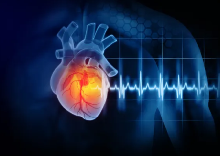 اندازه گیری خطر حمله قلبی