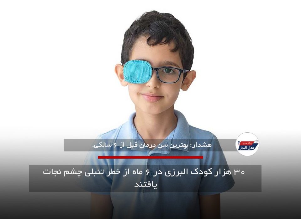 ۳۰ هزار کودک البرزی در ۶ ماه از خطر تنبلی چشم نجات یافتند