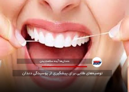 توصیه‌های طلایی برای پیشگیری از پوسیدگی دندان
