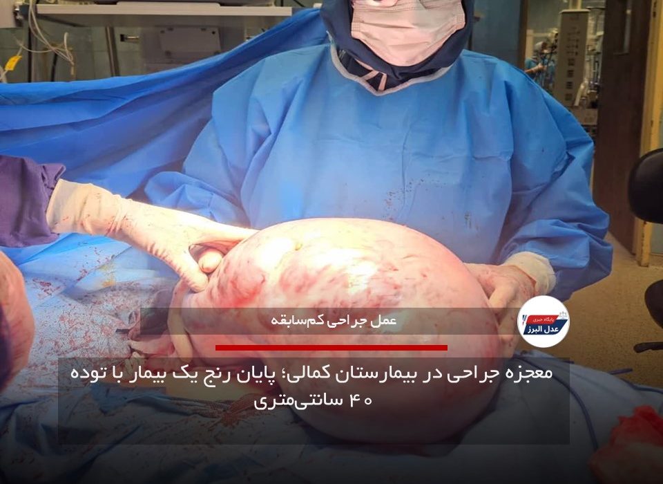  معجزه جراحی در بیمارستان کمالی| پایان رنج یک بیمار با توده ۴۰ سانتی‌متری
