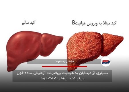 بسیاری از مبتلایان به هپاتیت بی‌خبرند؛ آزمایش ساده خون می‌تواند جان‌ها را نجات دهد