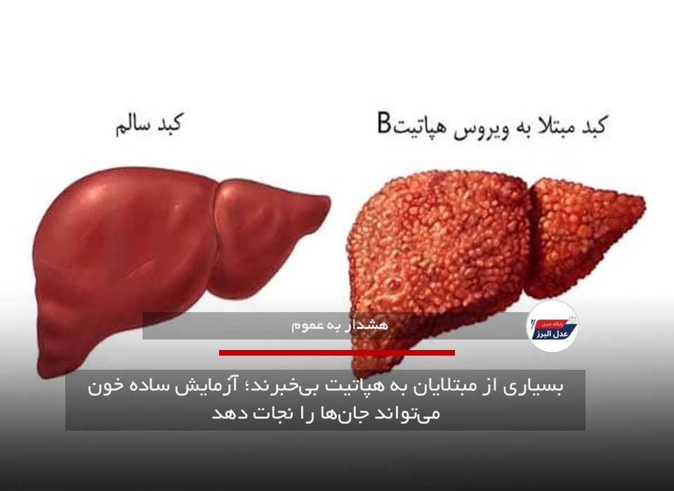 بسیاری از مبتلایان به هپاتیت بی‌خبرند؛ آزمایش ساده خون می‌تواند جان‌ها را نجات دهد