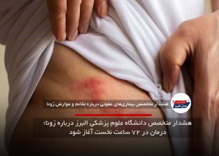 هشدار متخصص دانشگاه علوم پزشکی البرز درباره زونا؛ درمان در ۷۲ ساعت نخست آغاز شود